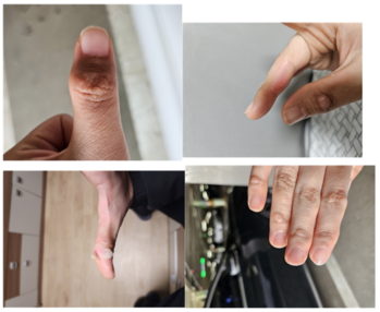 thumbimg